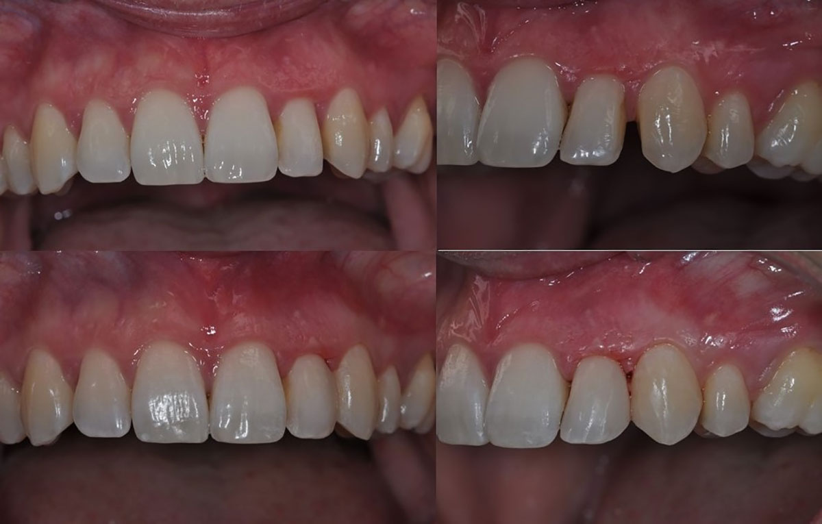 estética-dental-caso-1
