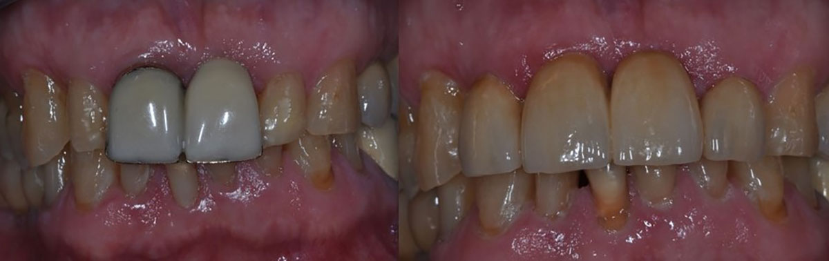 estética-dental-caso-2